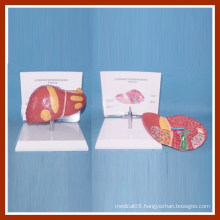 Human Common Pathologies of Liver Model with Description Plate